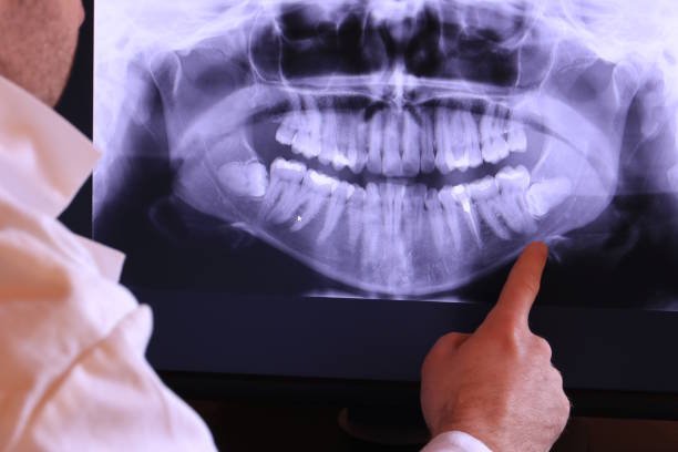 Best Emergency Dentist for Knocked-Out Tooth in West Point, GA