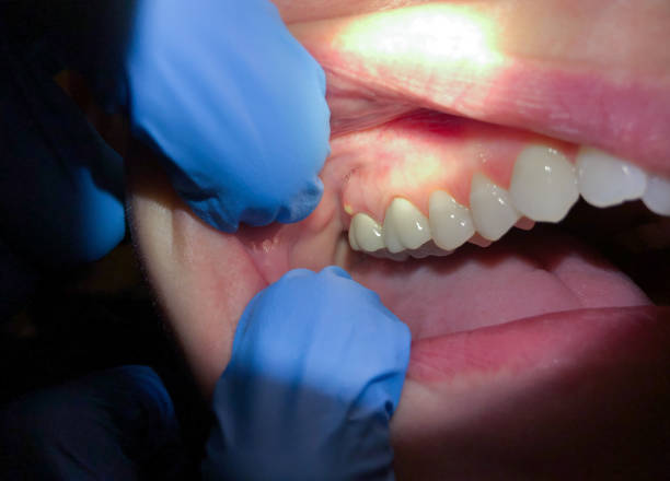 Best Broken or Cracked Tooth Emergency Dentist in West Point, GA